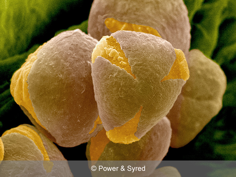 Spores, Seeds & Pollen - PS micrographs