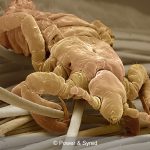 human louse