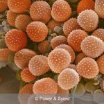 fungal rust spores