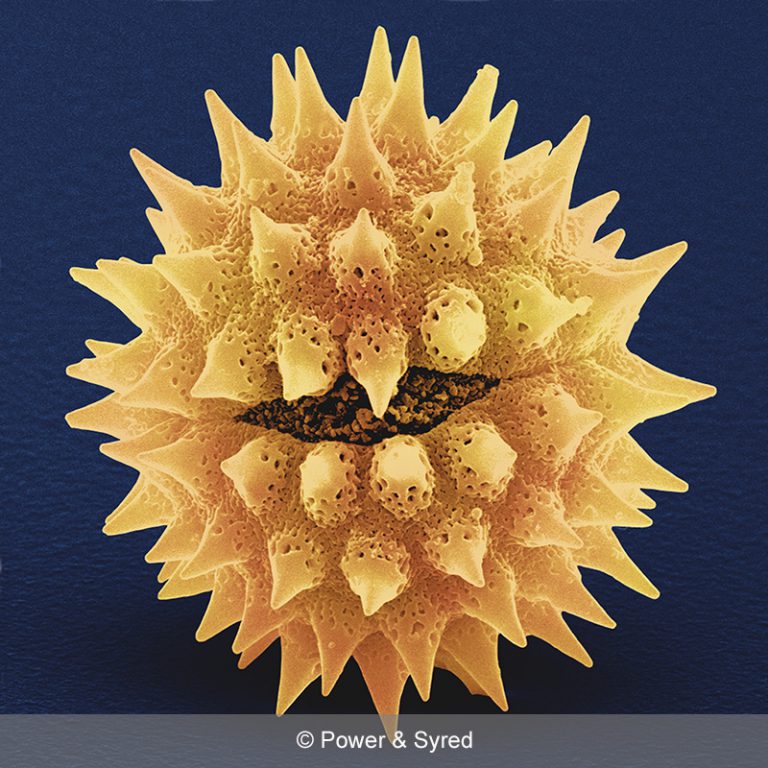 Spores, Seeds & Pollen PS micrographs